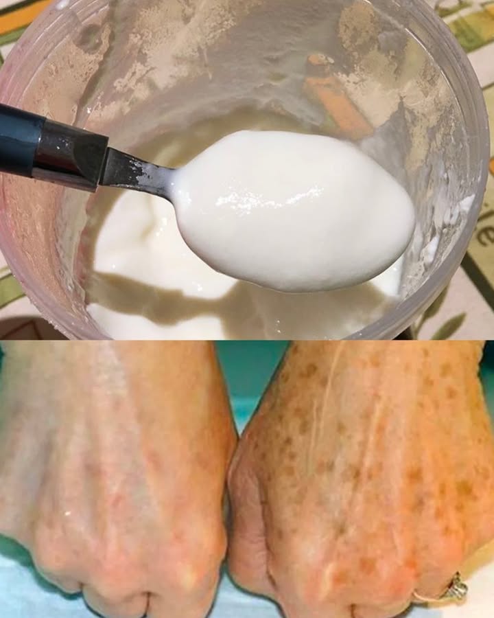 How To Lighten Stains On The Hands