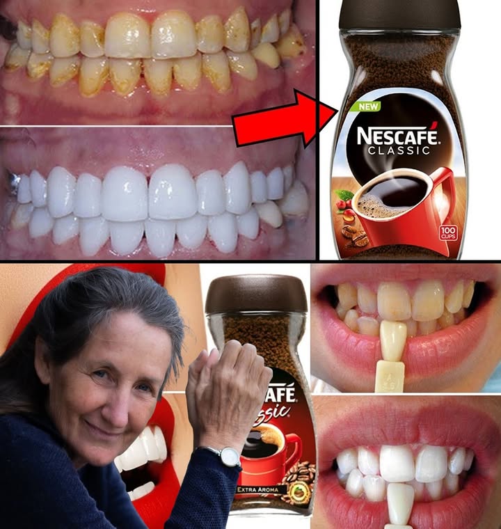 Whiten Your Teeth at Home